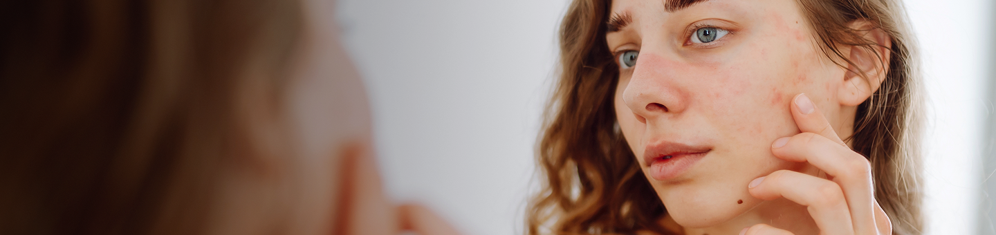 porque queremos cuidar tu piel banner